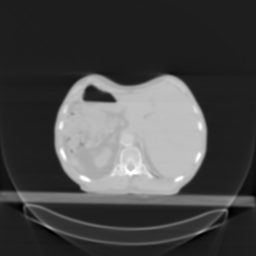 Animation slices of thorax data